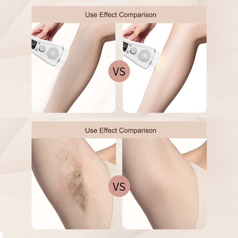 AmazeFan 990000 Flashes Laser Hair Removal IPL photon depilator For Women Household